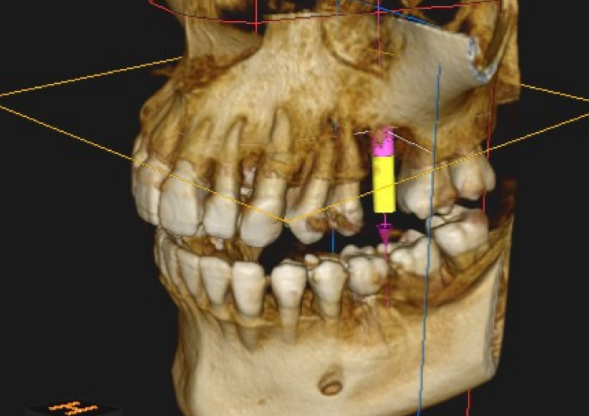 TAC Dental 3D